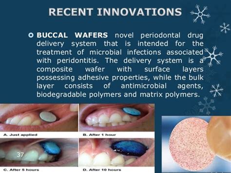 wafer define|what is wafer medication.